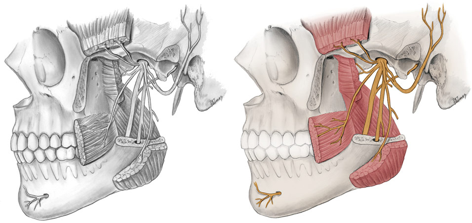 Jaw Example