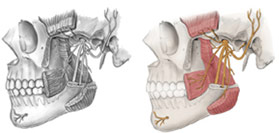 Before & After: Jaw